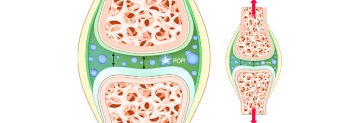 Chiropractic Nelson Tasman What is That Popping Sound