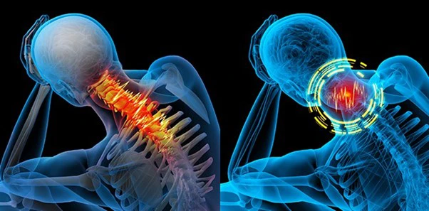 Chiropractic Nelson Tasman Neck Pain X Ray